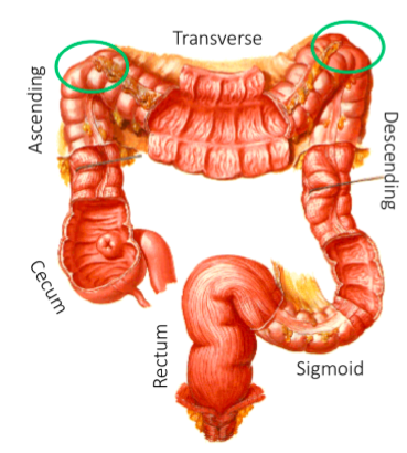 ascending colon pain in back