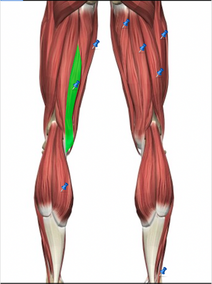 Wiley AAP Lab Quiz 5 -Gross Anatomy of the Muscular System Part 3