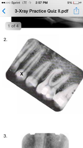 Print Dental Assisting X Ray Quiz 2 Flashcards Easy Notecards