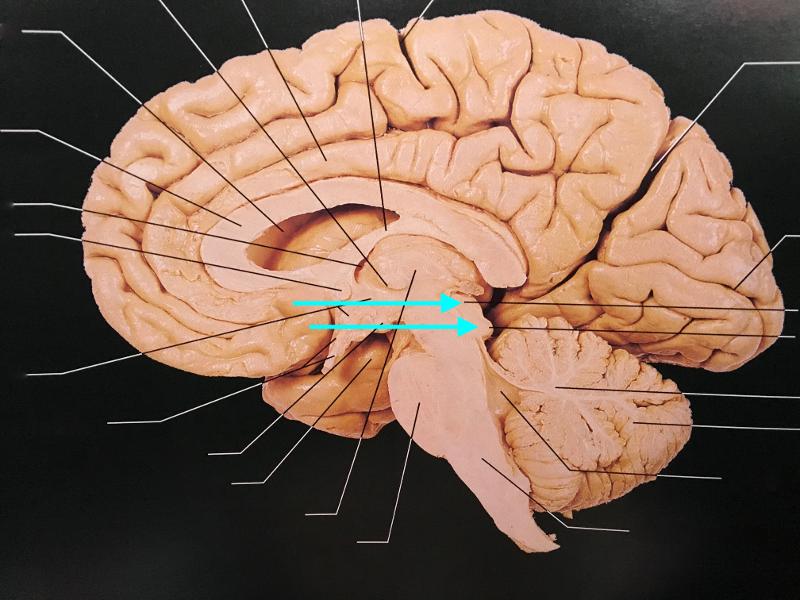 print-human-brain-flashcards-easy-notecards