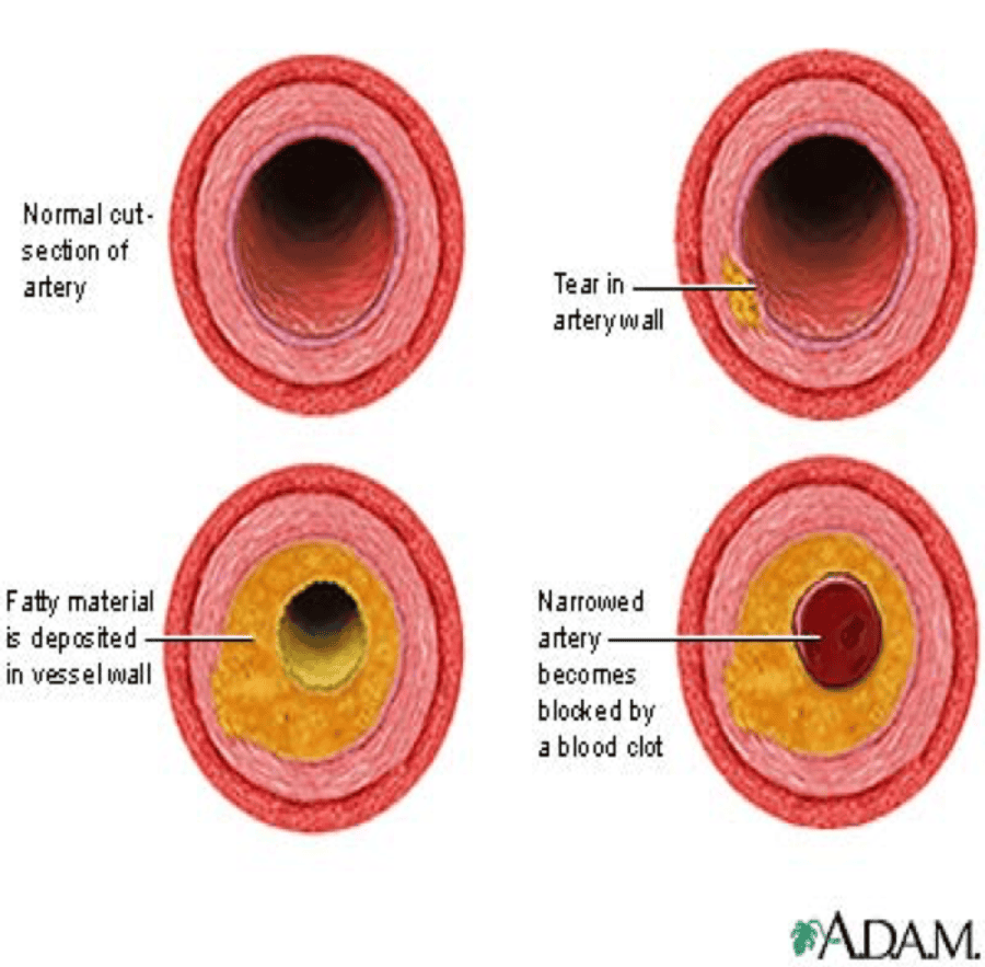 Cardiovascular System Review Flashcards Easy Notecards