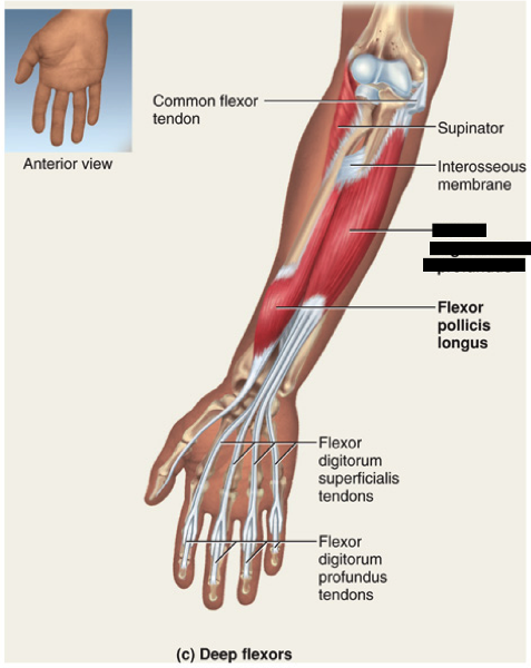 Common Flexor Tendon Tear - vrogue.co