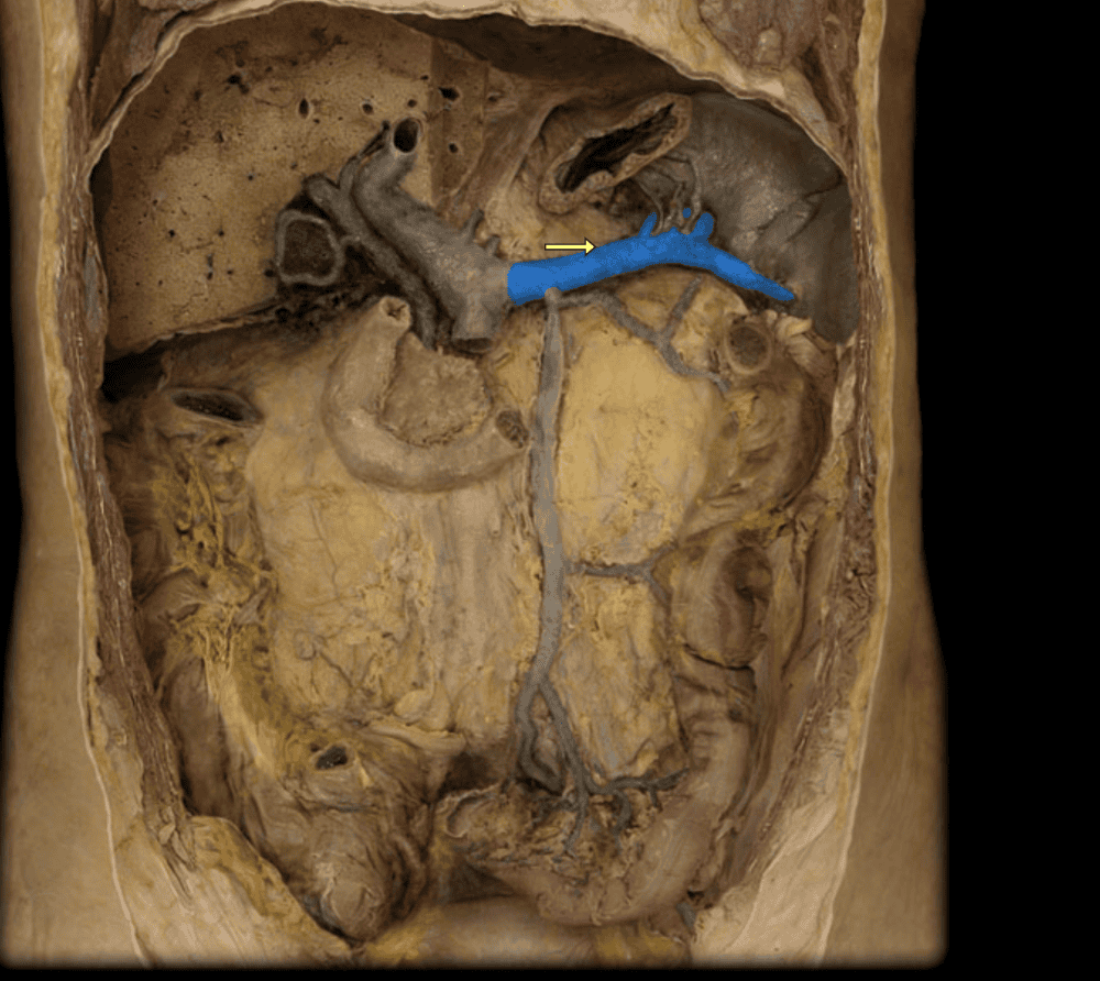 Брюшная полость фото. Папирус Corpus sine Spiritu cadaver est. Marilia Donca cadaver.