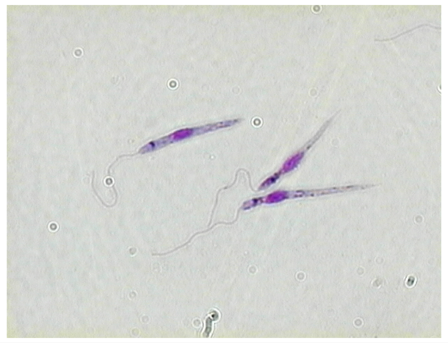 Leishmania donovani