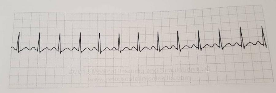 Print EKG Exam flashcards | Easy Notecards