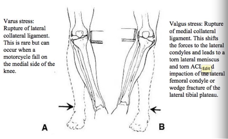 Ligaments of the Lower Limb Flashcards | Easy Notecards