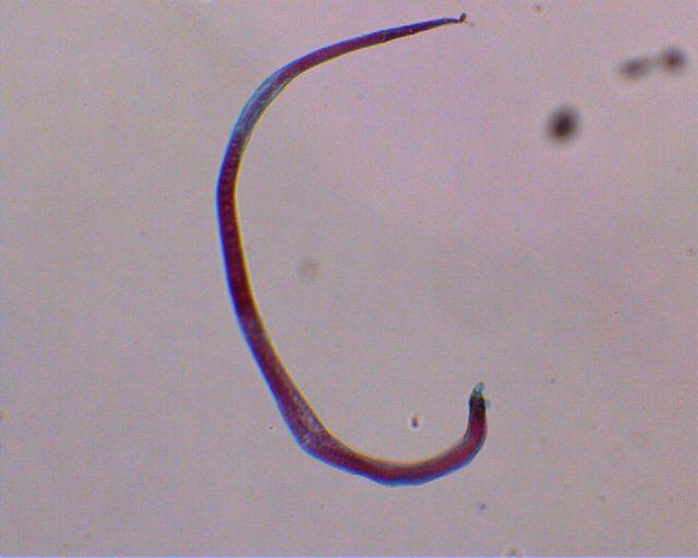 Trichinella igg. Трихинелла псевдоспиралис. Личинки трихинеллы под микроскопом. Трихинеллез под микроскопом.