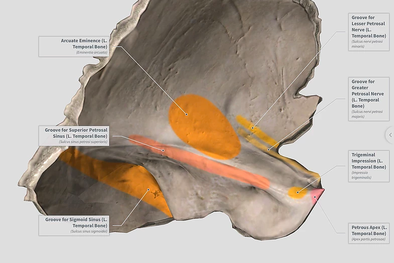 Каналы большого и малого каменистых нервов. Sulcus Sinus sigmoidei височная. Sulcus Sinus sigmoidei височная кость. Расщелина канала большого Каменистого нерва. Височная кость тройничное вдавление.