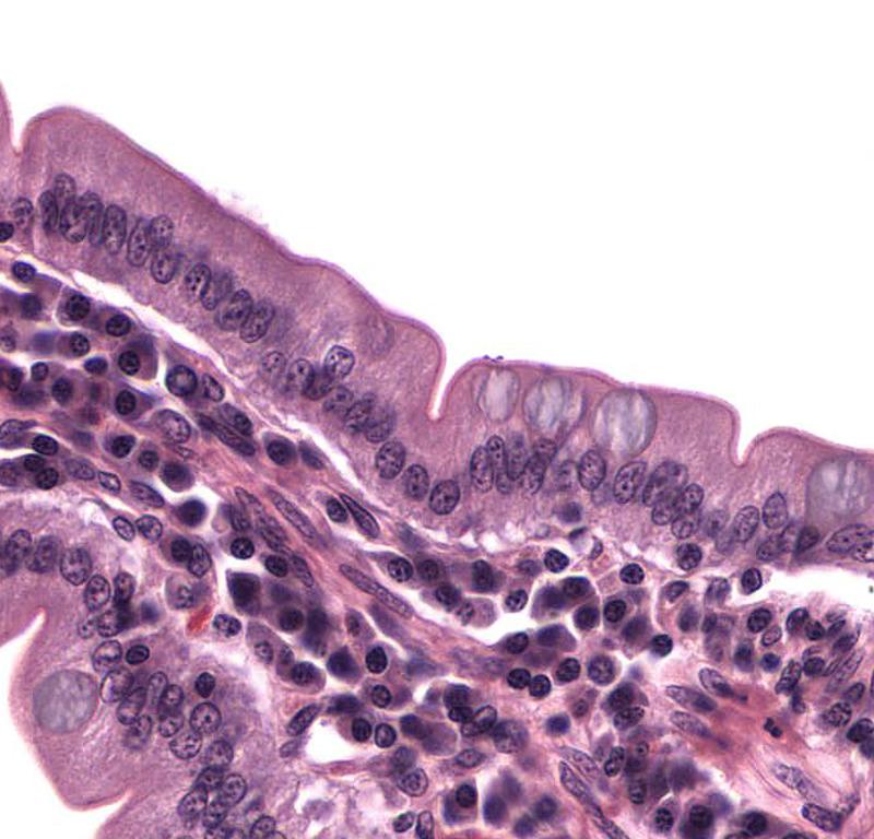 Print Epithelial Tissues: Activity 1 flashcards | Easy Notecards