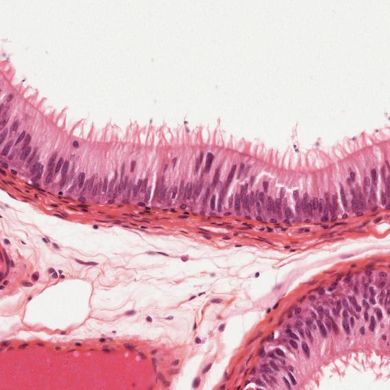 Print Epithelial Tissues: Activity 1 flashcards | Easy Notecards