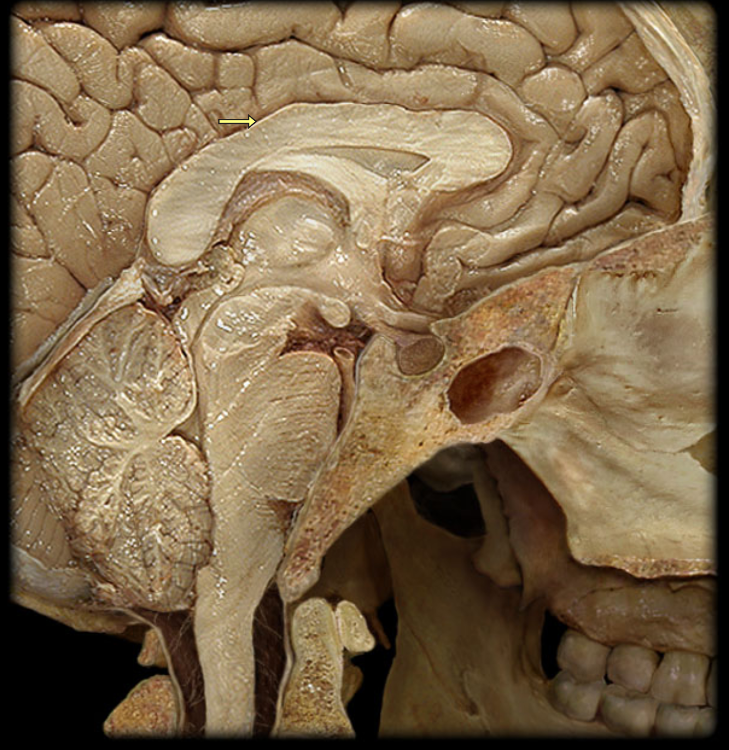 Свод мозга фото