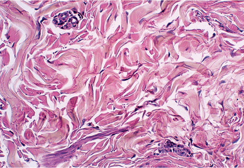 Print Histology: Epithelial & Connective Tissue flashcards | Easy Notecards