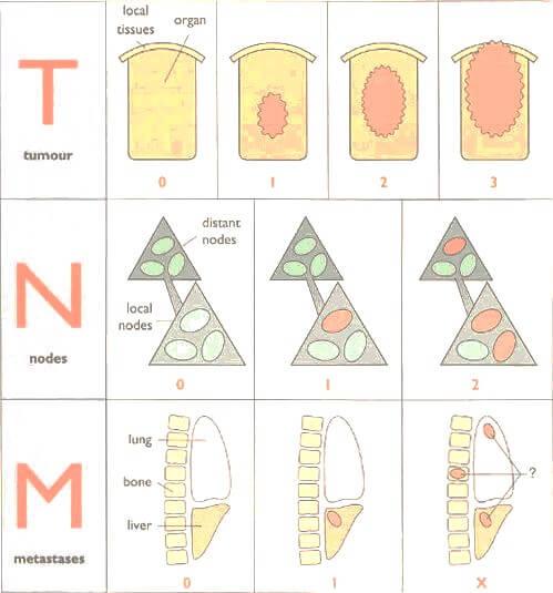 biology of cancer Flashcards | Easy Notecards