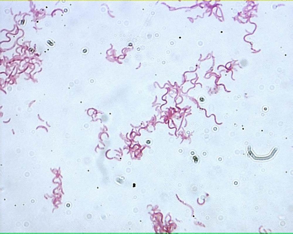 microbiology bacteria shapes