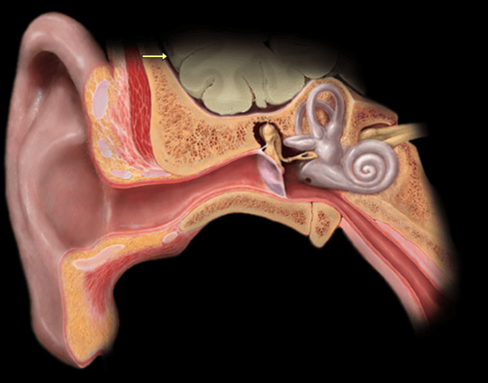 Кость среднего уха. Auditory ossicles. Cavitas Tympani.