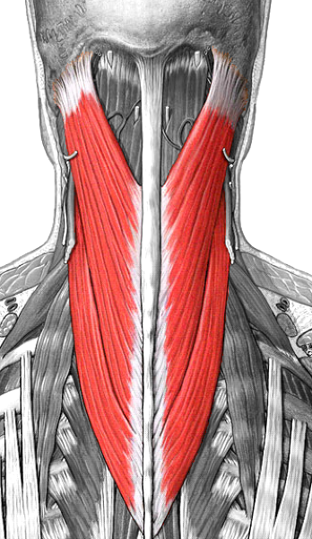 Отекшие мышцы. Разгибатели шеи мышцы анатомия. Длинные разгибатели шеи анатомия. Splenius capitis мышца. Длинные экстензоры шеи анатомия.